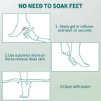 NAILPOP Extra Strength Callus Remover for Feet and Foot File Kit Remove Hard Skins Heels and Tough Callouses from Feet Quickly