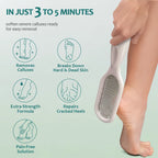 NAILPOP Extra Strength Callus Remover for Feet and Foot File Kit Remove Hard Skins Heels and Tough Callouses from Feet Quickly